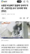 뇌종양 세 살배기 아이 얼굴에 손바닥 자국...