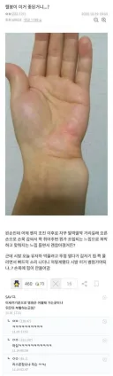 의사까지 웃겨버린 레전드 드립