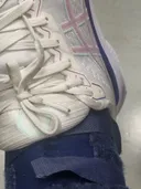정말정말 진짜 엄청 심한 유리발목 여시 있나요?