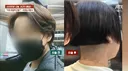 "여자도 많이 한다" 해서 믿었는데…투블럭 시술 뒤 '대참사'