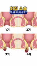 진짜 펑 하고 터지면 실제 폭탄만큼이나 위험한거