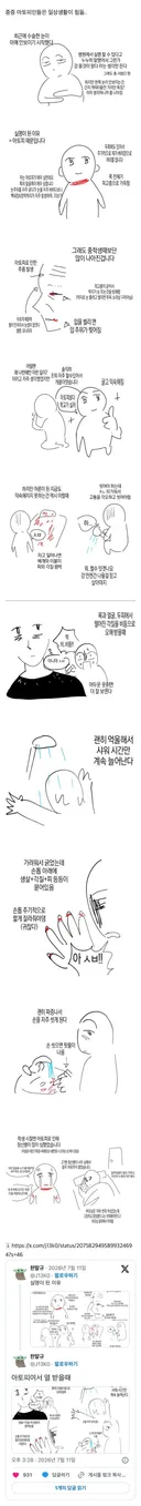 중증 아토피인들의 고충