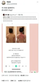 승모근 관리 1회만으로 어깨 라인이 정리 된 걸 알 수 있습니다!.jpg