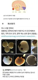 간도 심장도 다 이식이 되는데 눈은 안되는 이유
