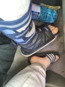 발 부쉈으면 베스트 보내준다면서요
