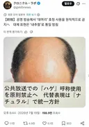 대머리를 대머리라 부르지 마라!!!!!!!!!!!!