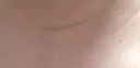 다들 자기 아픈걸로 베글 가는거야?
