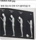 거북목이 너무 심하면 일어나는 몸의 변화