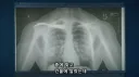 본인의 x레이 사진을 보고 현타 온 헬창