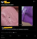 서코) 3번째 간식 테러 사건 근황