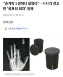 생활정보) 의사가 경고한 '공포의 위험한 의자'