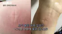 33년간 모기 연구한 교수님이 직접 말해주는 가려움 해소방법