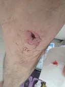 혐주의) 응급실 가야할까요?
