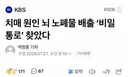 치매 원인 뇌 노폐물 배출 '비밀 통로' 찾았다