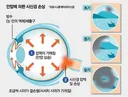 실명 원인 1위 녹내장… 40세 안과검진이 평생시력 좌우