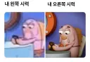 은근히 많다는 양쪽 눈 시력 차이.jpg