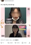 트젠 목소리 수술 전후