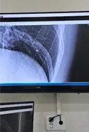 생수 배달하다 미끄러져 다친 쿠팡맨