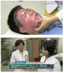 피부과 교수가 말해주는 선크림 적정량.jpg