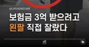 자신 왼팔을 직접 잘라 보험금 3억원 수령