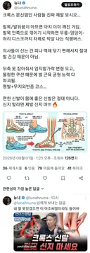 크록스 문신템인 사람들 진짜 제발 보시오