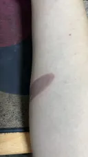 너네 용접 배울때 조심해라