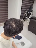 이거 탈모 맞나요?