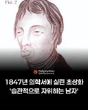 1847년 의학서에 실린 초상화