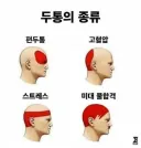 두통의 종류