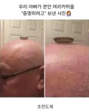 아빠가 머리카락 인증하는 사진