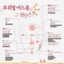 부위별 여드름 원인