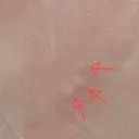 아오 피그미다람쥐 발톱이 모기 그자체임