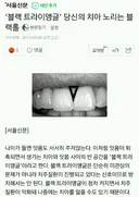 '블랙 트라이앵글' 당신의 치아 노리는 블랙홀