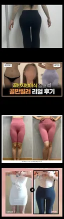 요즘 유행하는 골반 필러 효과