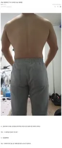 운동하다가 어깨가 아파 의사와 상담한 헬창