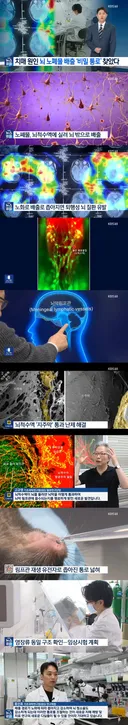국내 연구진, 치매 원인 찾았다