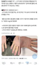 고기, 버터, 치즈만 먹는 극단적 다이어트를 한 사람의 손