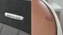 차에 탔다가 등에 'AMG 로고 모양' 화상…