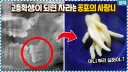 신체 부위중 가장 병 신같은 부위