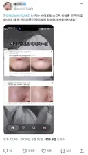 몰래 바이럴 작업하다 딱 걸린 마미케어 근황