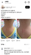 이걸 뒤집어? 넘어가?