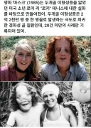 혐주의 사람들이 잘 모르는 희귀 질환