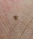 벼룩파리 새끼 빛의 속도로 잡았다.