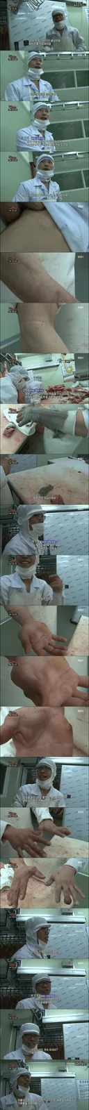돼지 발골 19년차의 손 상태