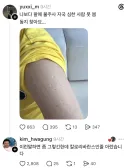 불주사 자국이 심하게 난 사람.