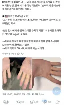 초극단적 다이어트로 학술지에 실린 사람의 손