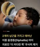 2개의 고추를 가지고 태어난 아이.jpg
