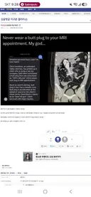 밑에 MRI글 보고 찾아온 애널 레일건 사건.JPG