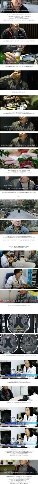 50대 애주가의 뇌 상태