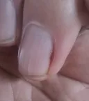약혐)며칠전에 있었던 끔찍한 사고